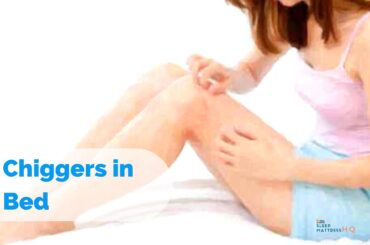 Chiggers in Bed